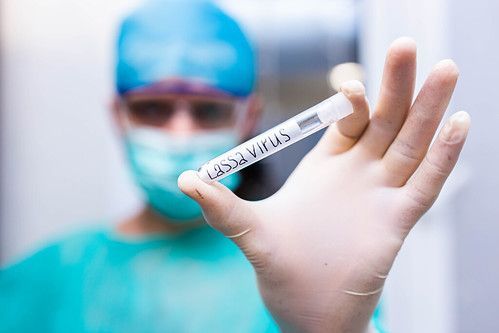 Qué riesgo implica el peligroso brote de fiebre de Lassa surgido en África