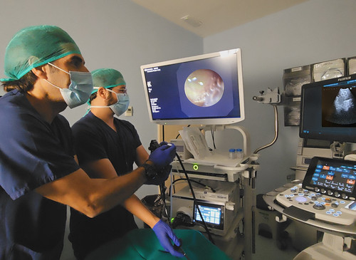 La ecobroncoscopia (EBUS) mejora el diagnóstico y la estadificación del cáncer de pulmón